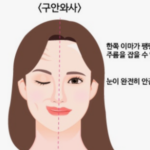 구안와사