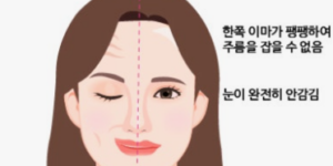 구안와사